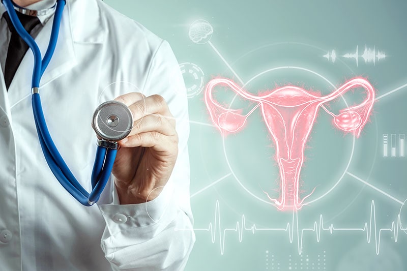 La endometriosis: Signos y tratamiento