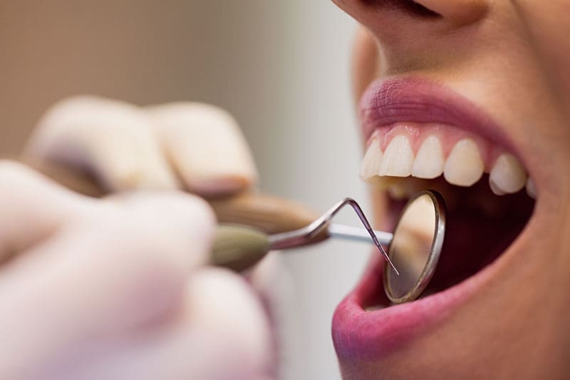 ¿Qué es la estética dental?