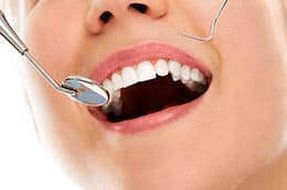 ¿Qué es el raspado dental?