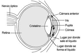 glaucoma